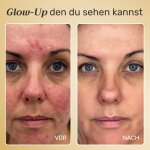 NuroDerma image