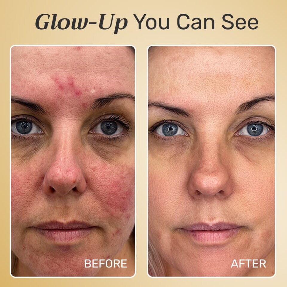 NuroDerma image